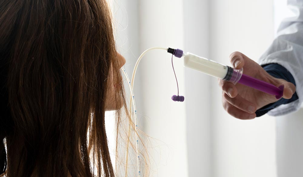 Nutrition entérale réalisée par une infirmière
